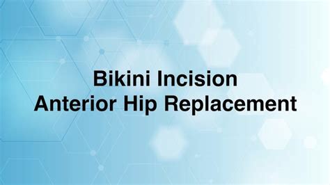 hip replacement rhode island|hip replacement lifespan.